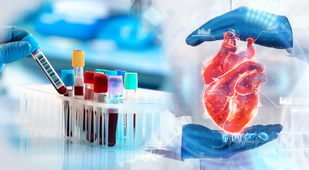 Proteína C reactiva de alta sensibilidad para prevención cardiovascular